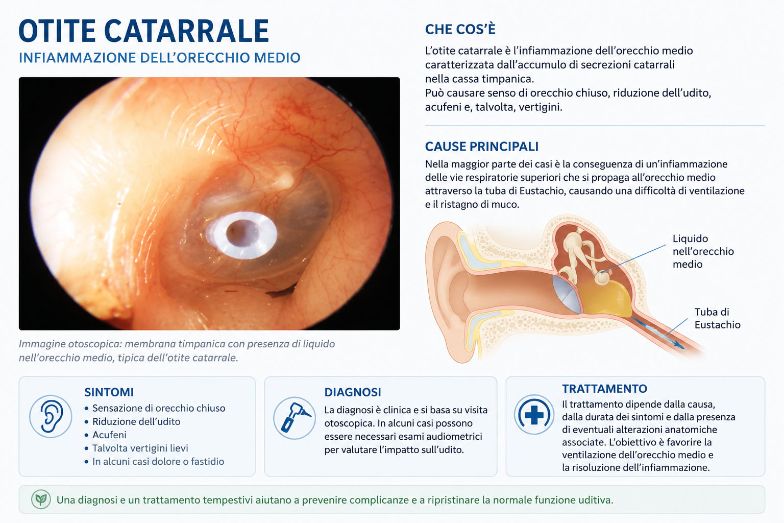 Otite catarrale